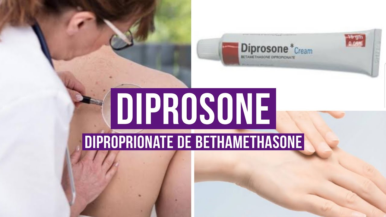 DIPROSONE (Dipropionate de bétaméthasone)