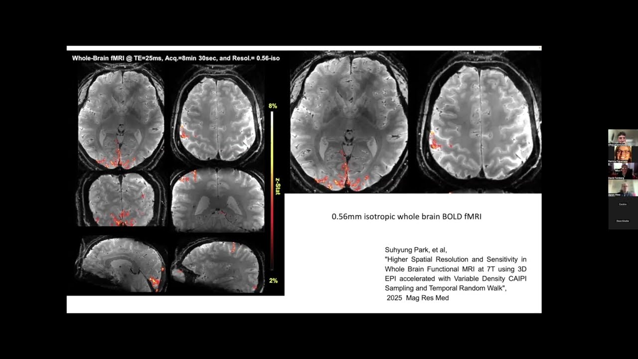 Tuning your scanner for fMRI, a virtual ISMRM Brain function study group meeting