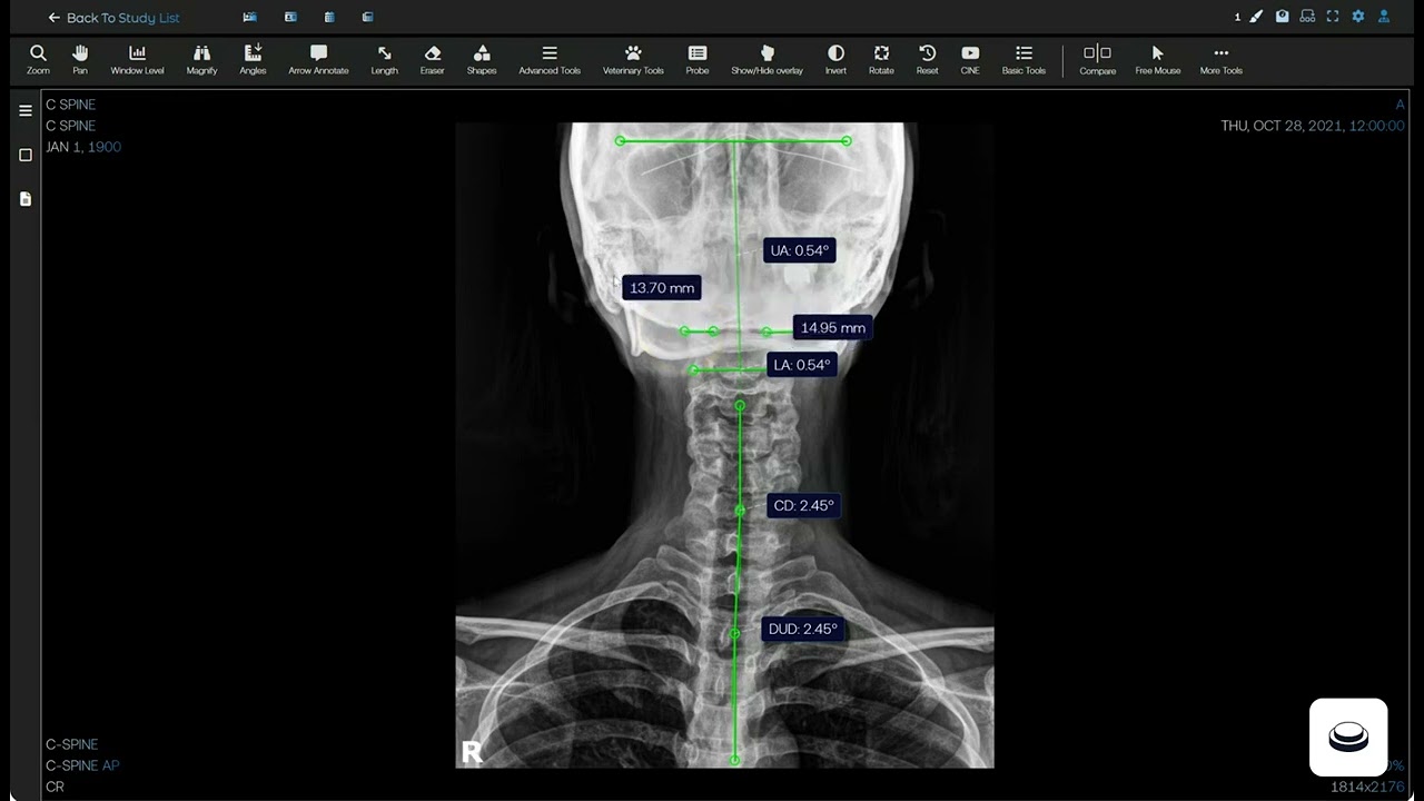 Voyance _ Nasium Xray Analysis