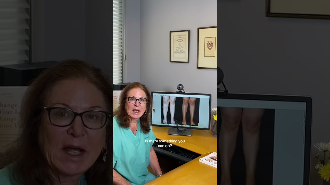 Cankles? Ankle Liposuction for Defined Legs #AnkleLipo #BodyContouring #shorts #cankles #legsday