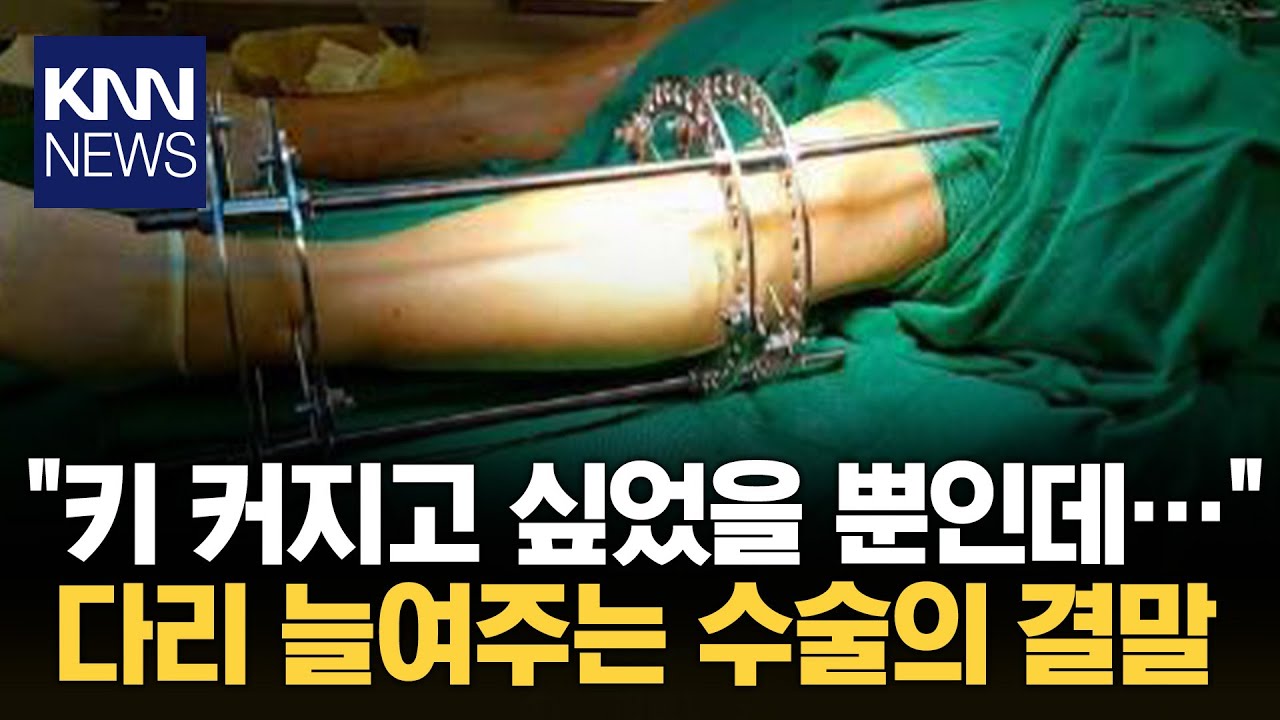 키 크는 수술 이후…부작용에 