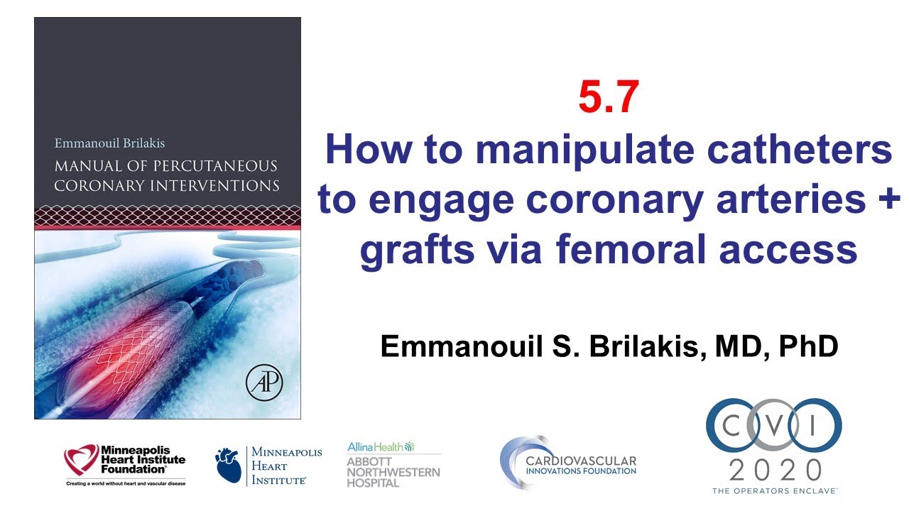 5.7 Manual of PCI - How to manipulate catheters to engage via femoral access