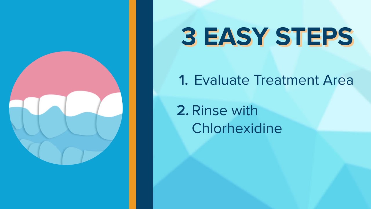 Propel Excellerator™ Series - See How It Works!
