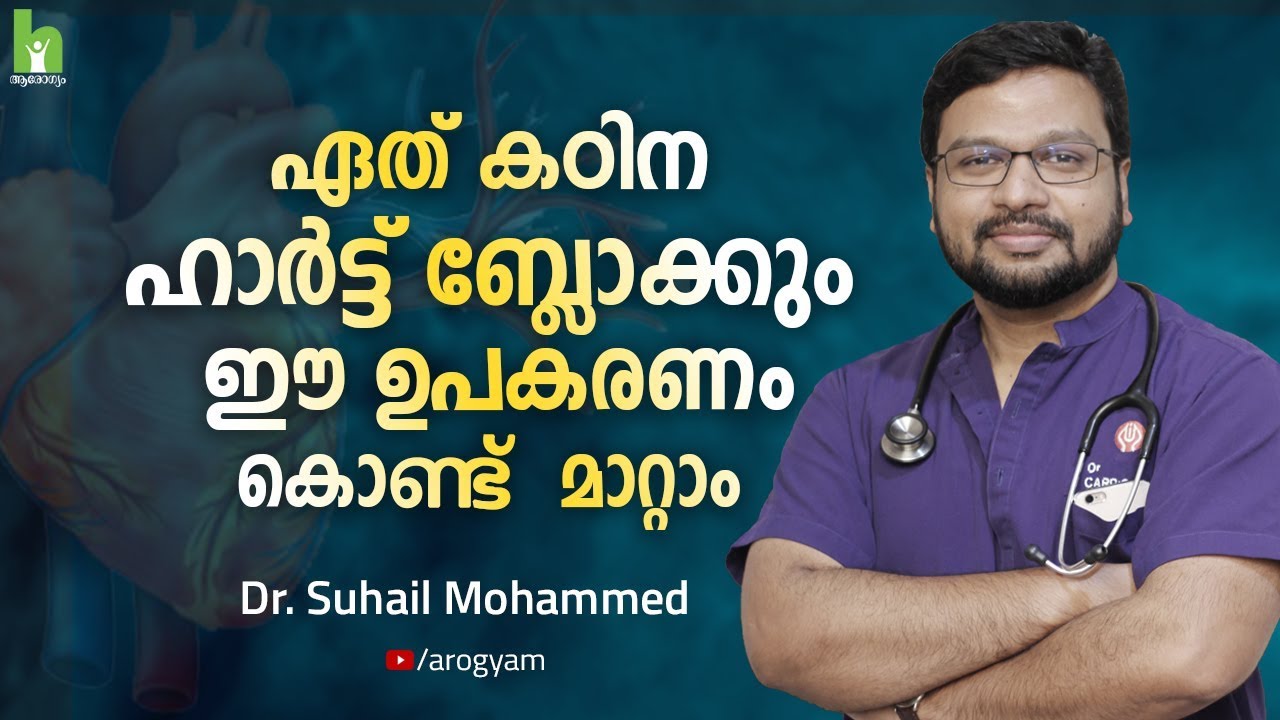 ഏതു കഠിന ഹാർട്ട് ബ്ലോക്കുകളും ഈ ഉപകരണം കൊണ്ട് മാറ്റാം | Malayalam Health Tips | Arogyam