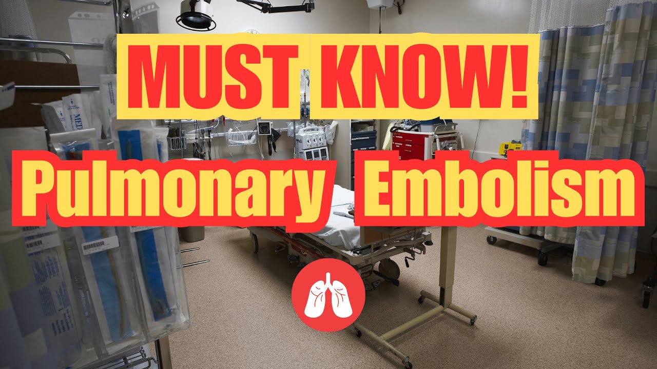 Pulmonary Embolism in the ER: What to Do When Your Patient Starts Crashing