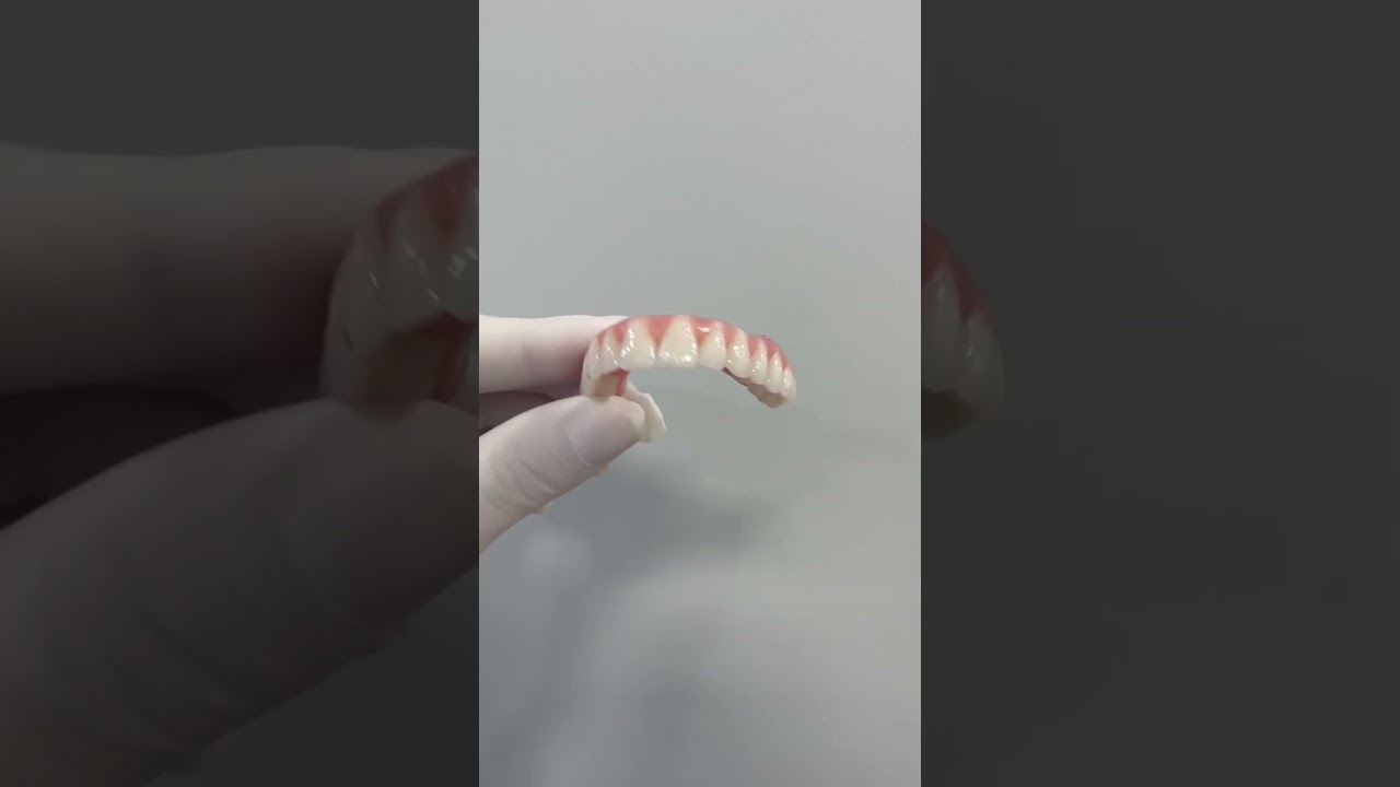 Protese protocolo sobre implantes