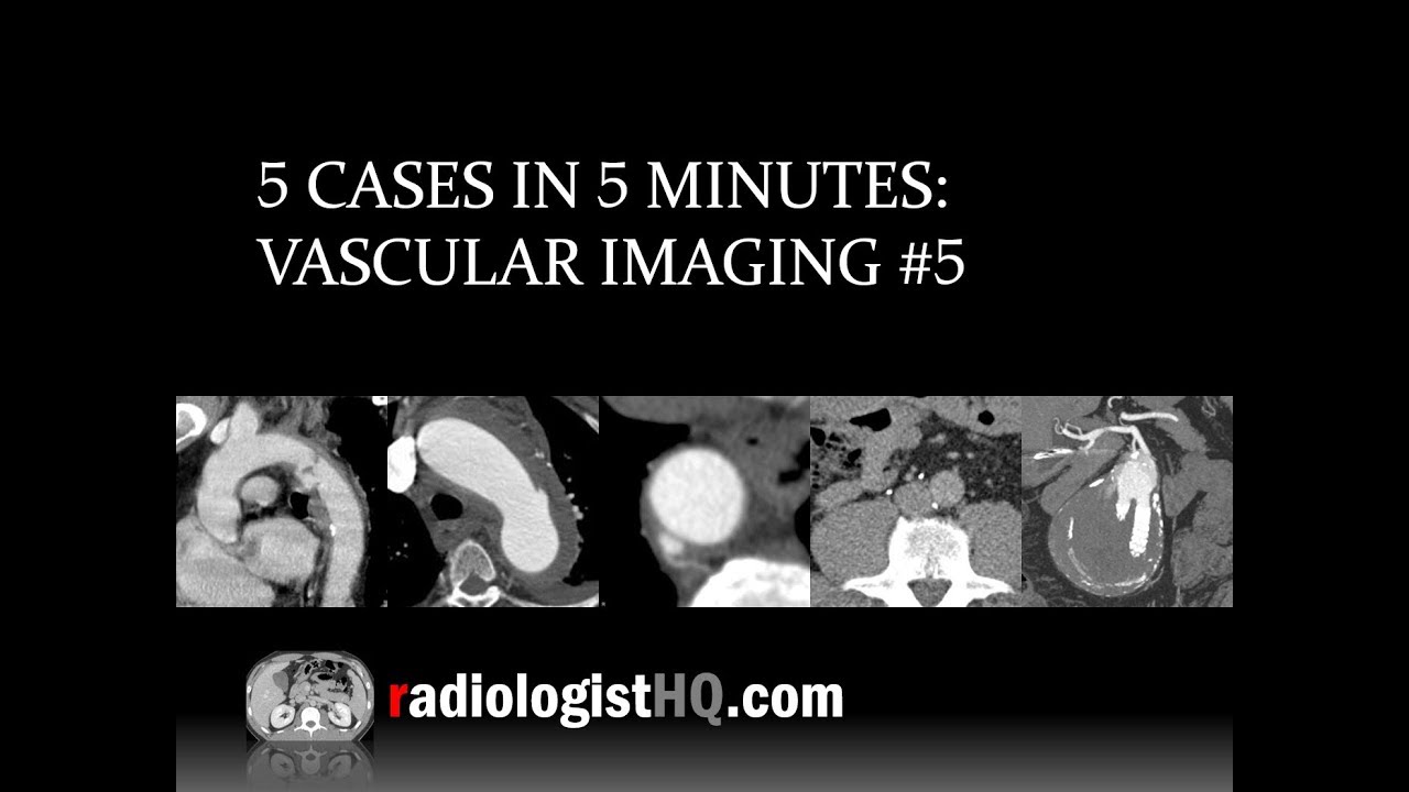 5 Cases in 5 Minutes: Vascular #5