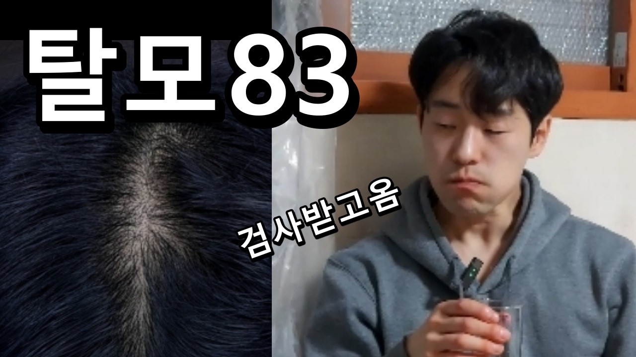 탈모 판정받고 한잔했습니다