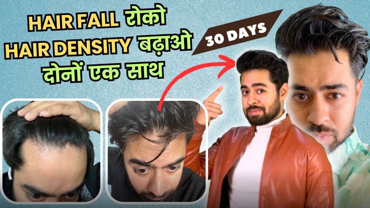 100% HAIRFALL रुकेगा और HAIR DENSITY DOUBLE हो जाएगी | ULTIMATE MEN'S HAIR CARE ROUTINE