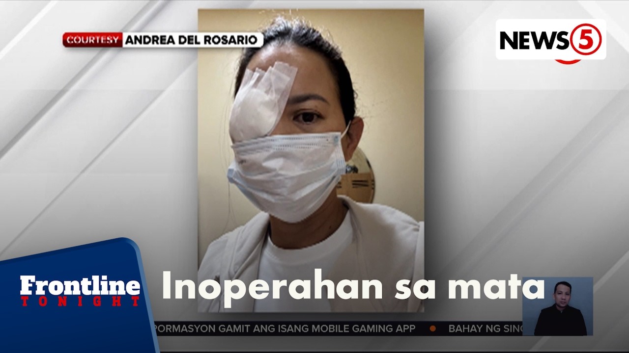 Andrea del Rosario, naoperahan sa mata dahil sa fake lashes | Frontline Tonight