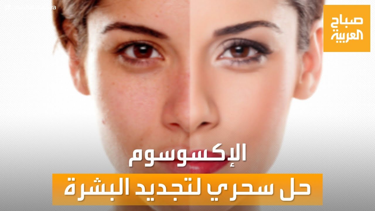 صباح العربية | الإكسوسوم.. الحل السحري لتجديد البشرة ومكافحة الشيخوخة