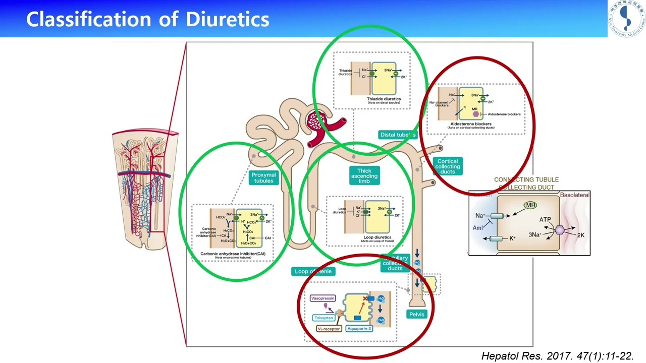 Peripheral Edema: When and How Should Diuretics Be Used?