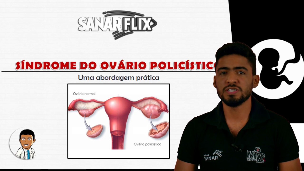Síndrome dos ovários policísticos (SOP) - Aula SanarFlix