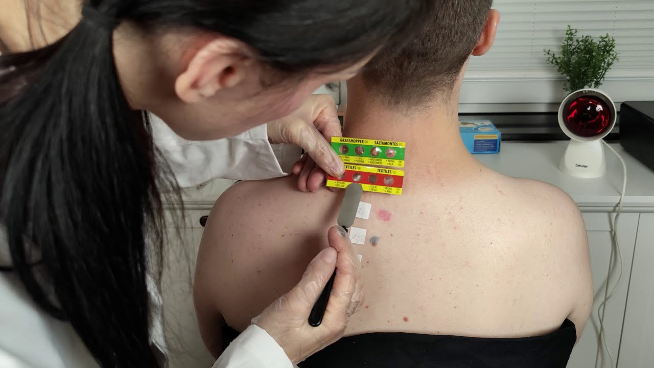Allergy Skin Test & Check Up On The Back [ASMR] *Annual Doctor Visit*