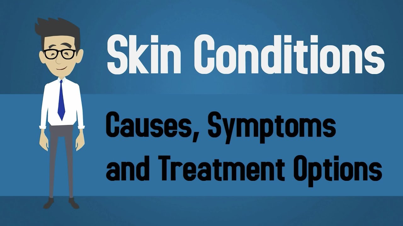 Skin Conditions - Causes, Symptoms and Treatment Options