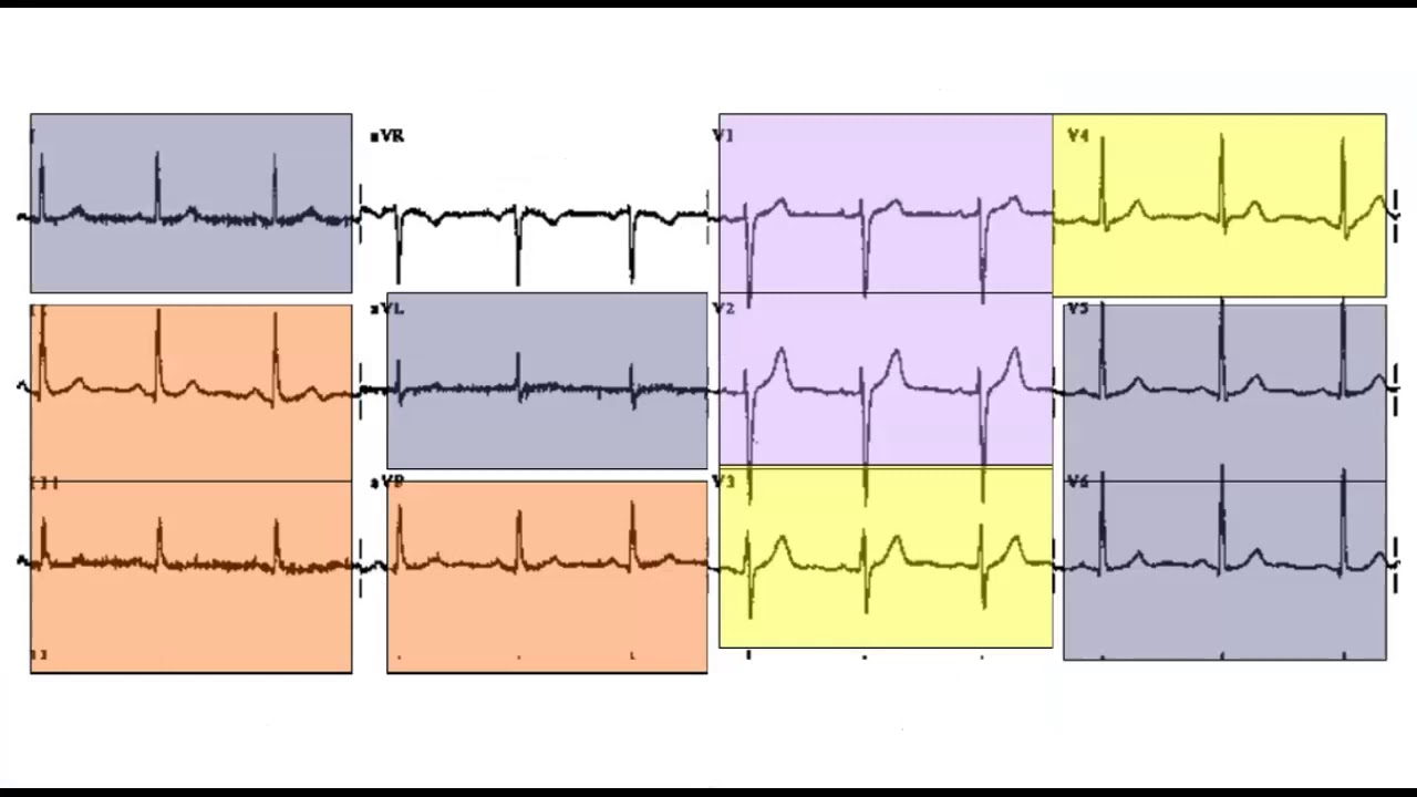 CEN Review Cardiovascular Emergencies Part 1