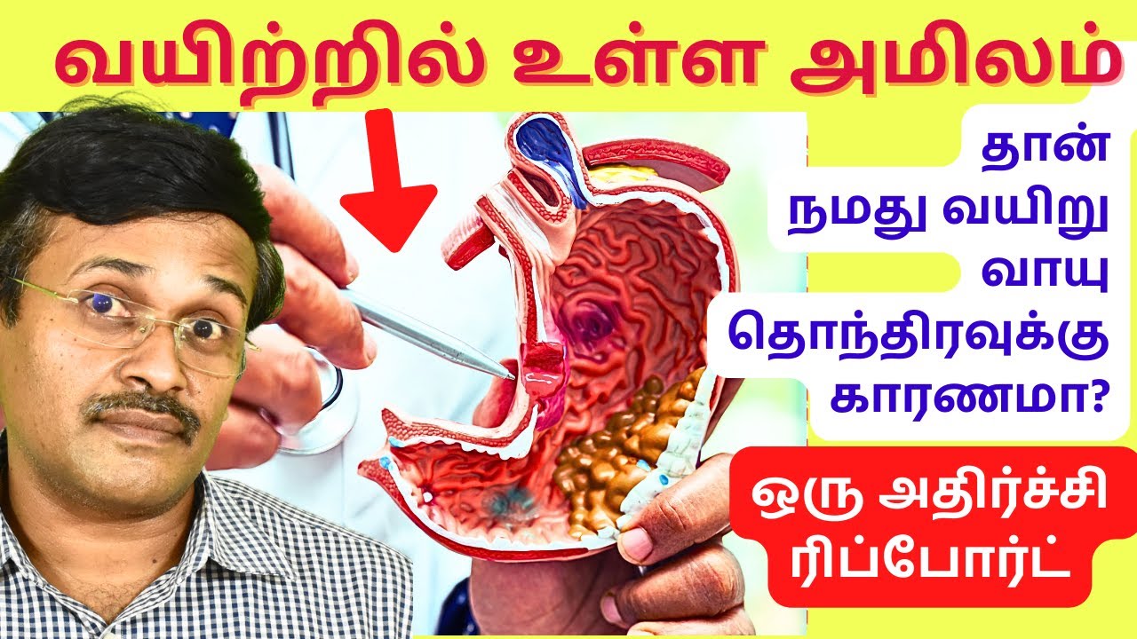 வயிறு வாயு hcl அமிலம் தொந்திரவு | hydrochloric acid stomach pain gas problem solution