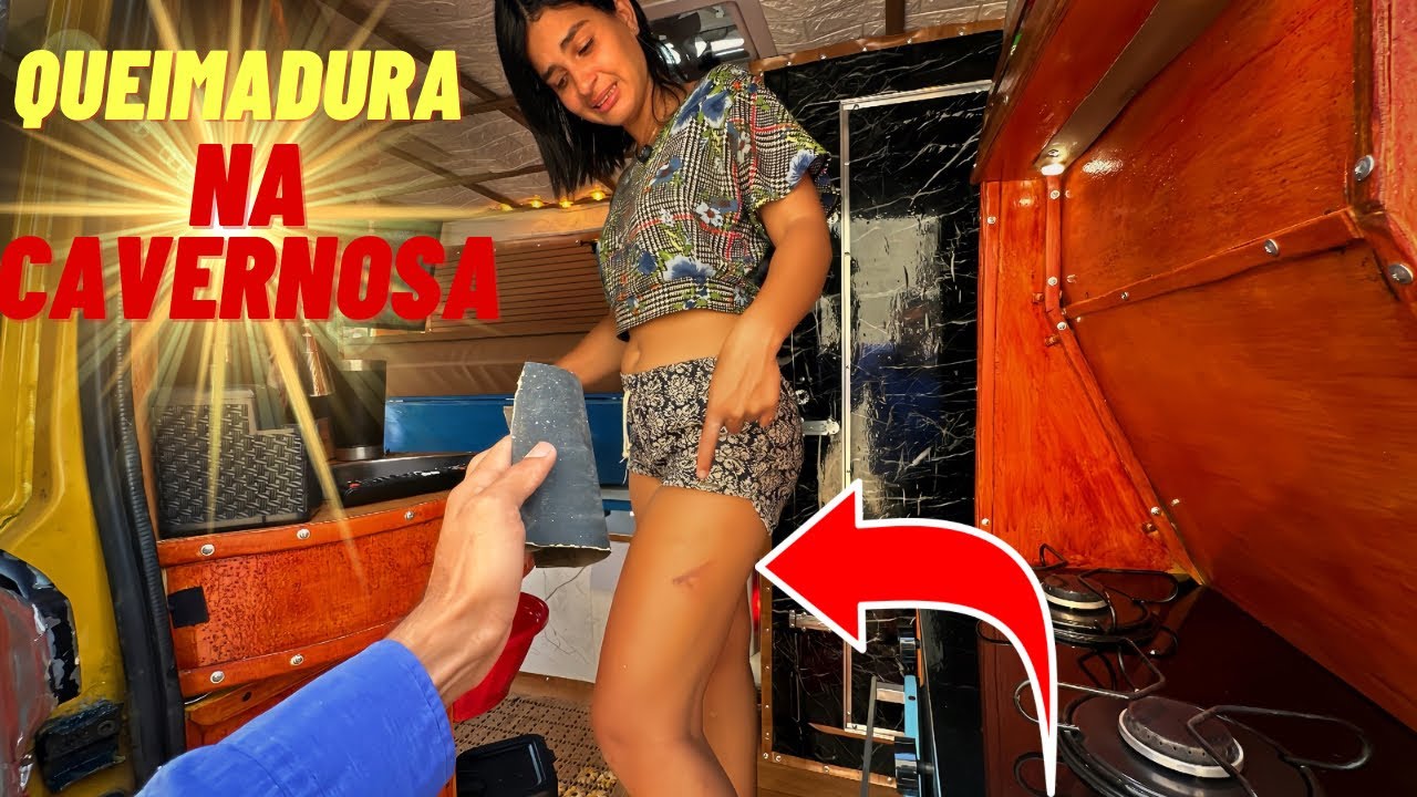 Ela sofreu uma QUEIMADURA ,ISSO NÃO PODE ACONTECER NOVAMENTE