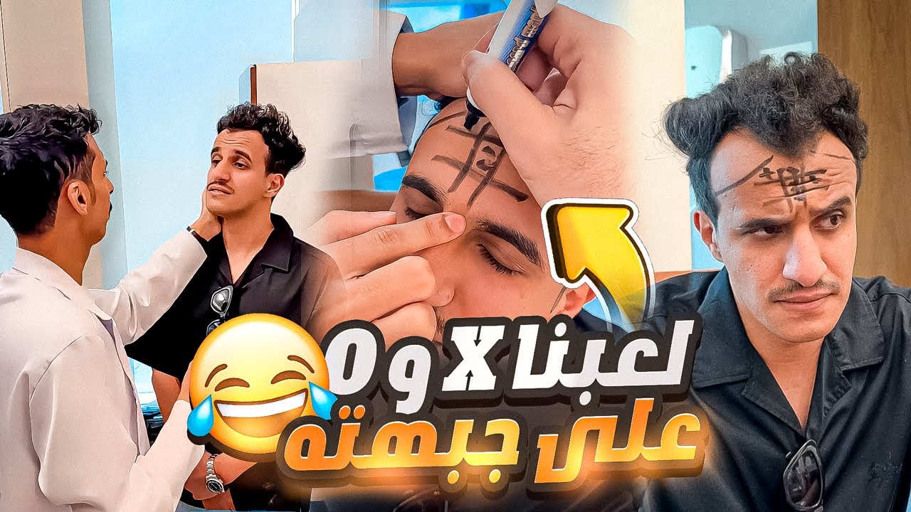 رائد يخطط زراعة الشعر لصناطيح عايض 🤣