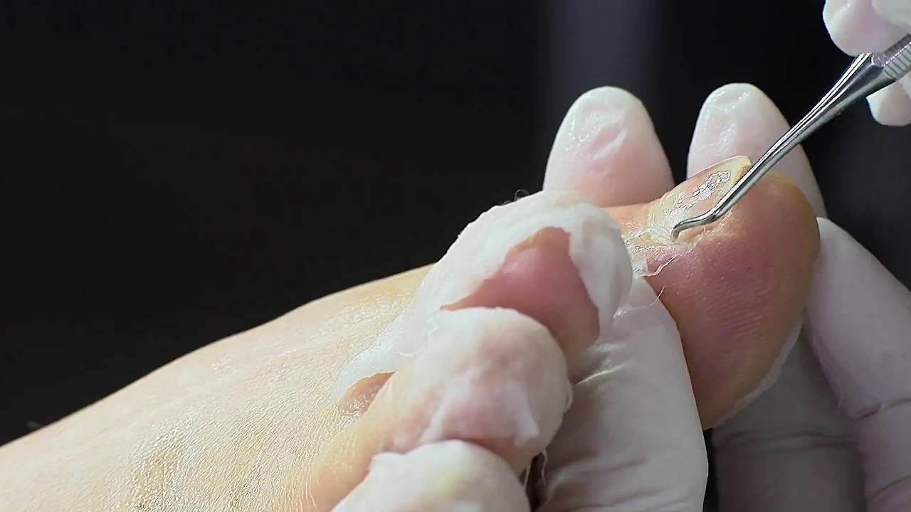 Medische pedicure Sabine