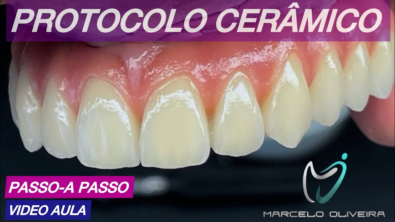 PASSO A PASSO DE PROTOCOLO CERÂMICO GC initial 🇵🇹