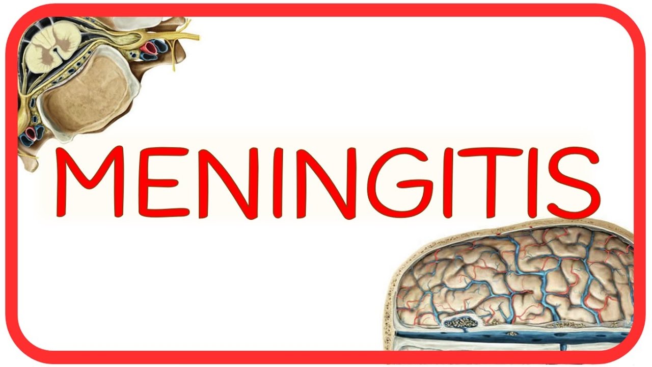 MENINGITIS - fisiopatología, signo de Brudzinski y Kernig, diagnóstico diferencial LCR y tratamiento