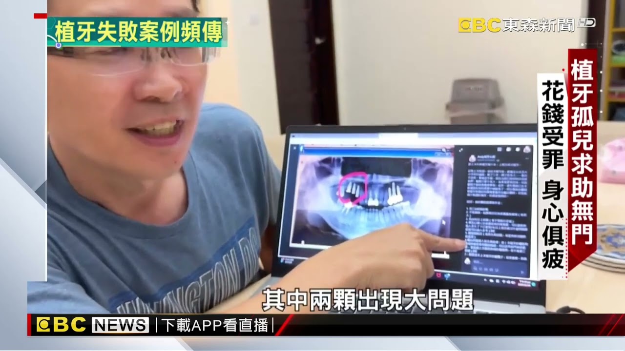 【聚焦真相】植牙孤兒慘碰壁！ 牙根碎裂求助無門 楊尚仁 李仲祥報導 @newsebc