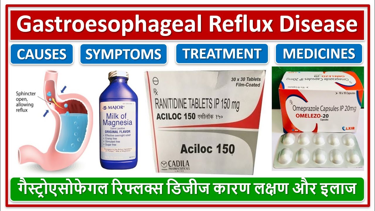 GERD, Medicines for Gastroesophageal Reflux Disease,गैस्ट्रोएसोफेगल रिफ्लक्स डिजीज, कारण,लक्षण, इलाज