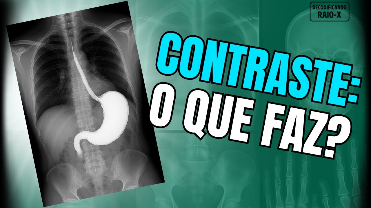 O Que o CONTRASTE Faz Dentro do Corpo? (E o Que Ninguém Conta)