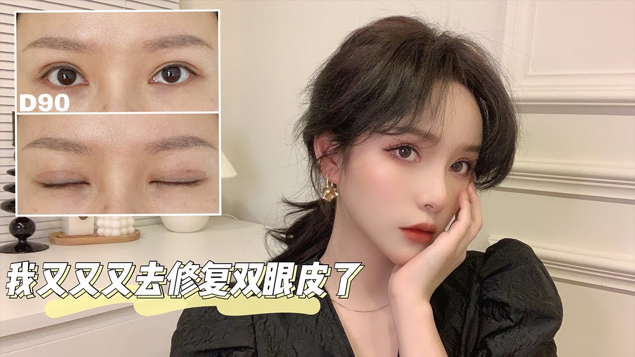 【我又又又去修復雙眼皮了】希望我走的彎路你們都別走！ 【陳奕伊Chen11】