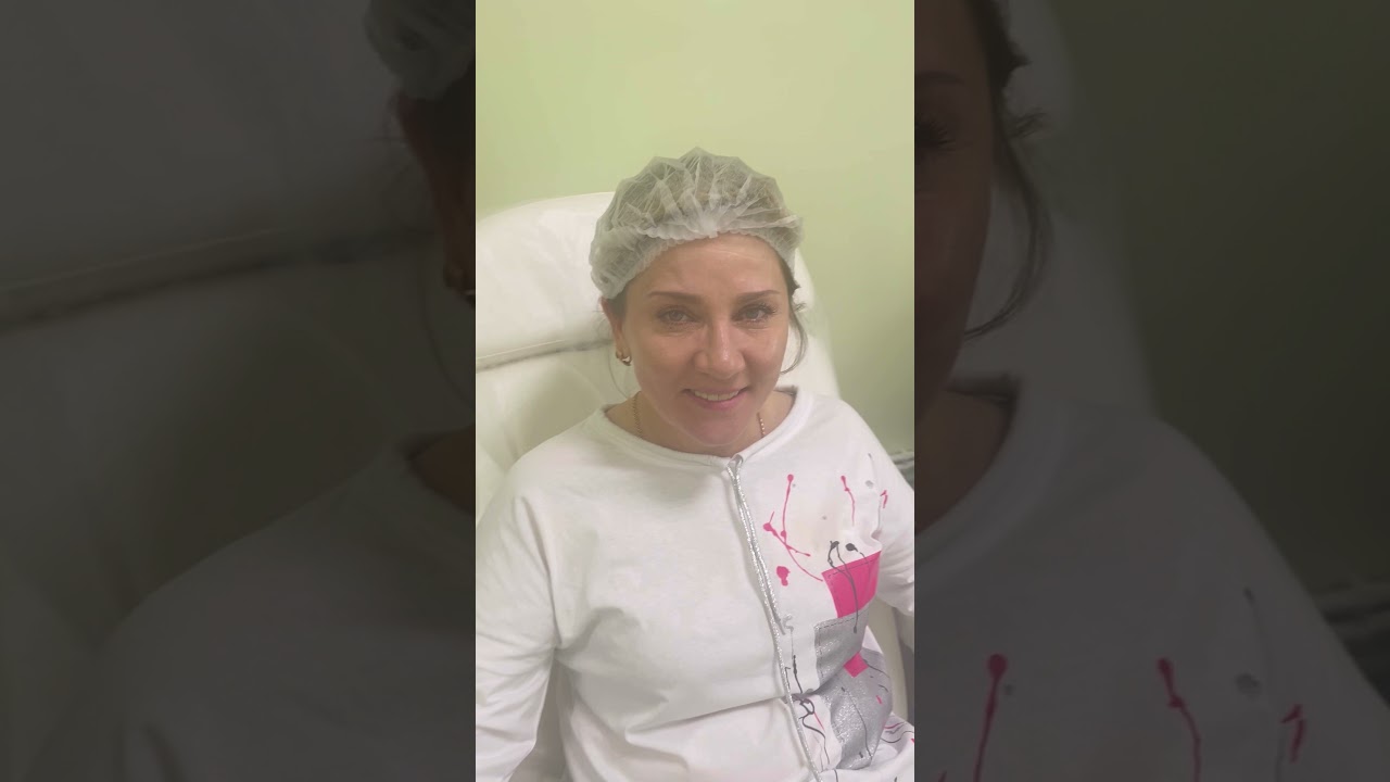 Лечение морщин  #skincare  #botox #lashes #microblading #beforeandafter #beauty #facial #filler