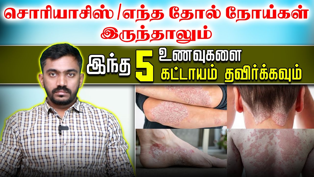 அனைத்து தோல் நோயாளிகளும் தவிர்க்க வேண்டிய (ம) சாப்பிட வேண்டிய உணவு முறை Foods to Avoid for Psoriasis