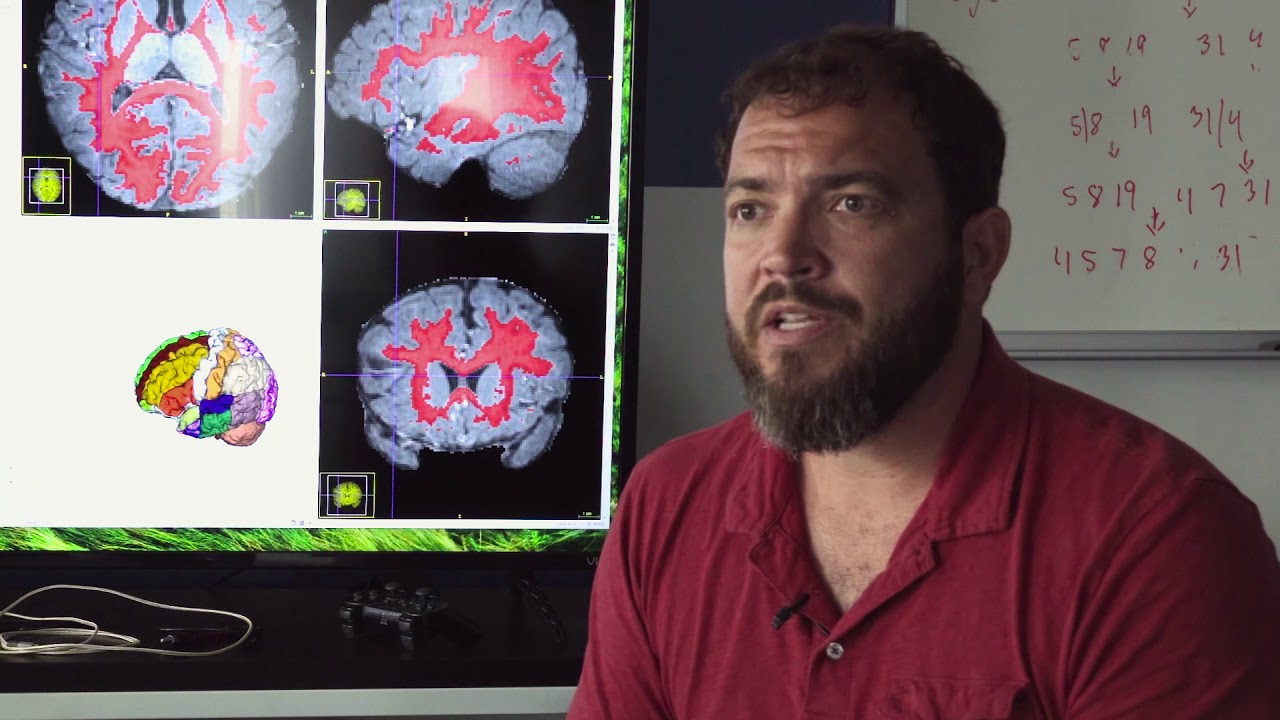 Brent Munsell – Helping to Pioneer Computer Mapping of the Brain