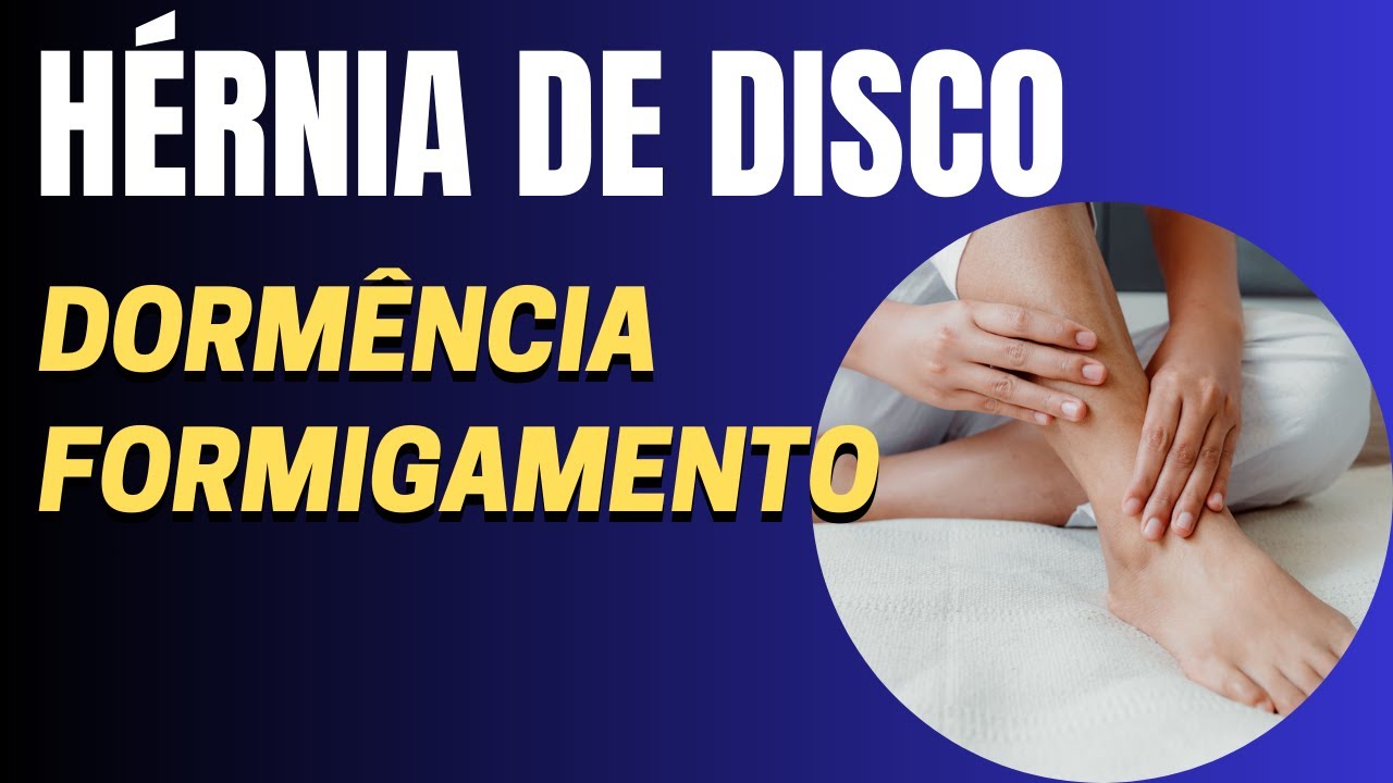 Dorm&ecirc;ncia ou Formigamento na H&eacute;rnia de Disco