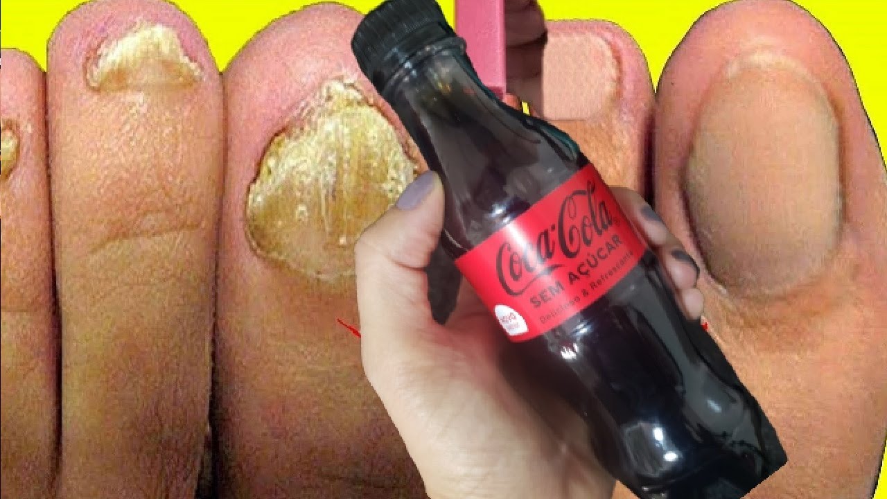 JOGA Coca-Cola NA UNHA PODRE E VELHA AS MANICURES V&Atilde;O ME DETESTAR DEPOIS DISSO - 2 DIAS APENAS!!