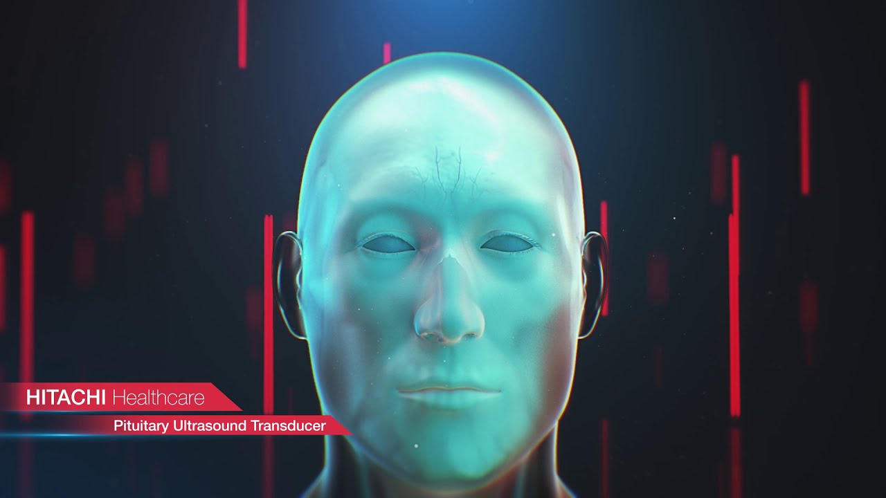 See Inside Tumors Using Hitachi's Pituitary Transducer (3D medical animation)
