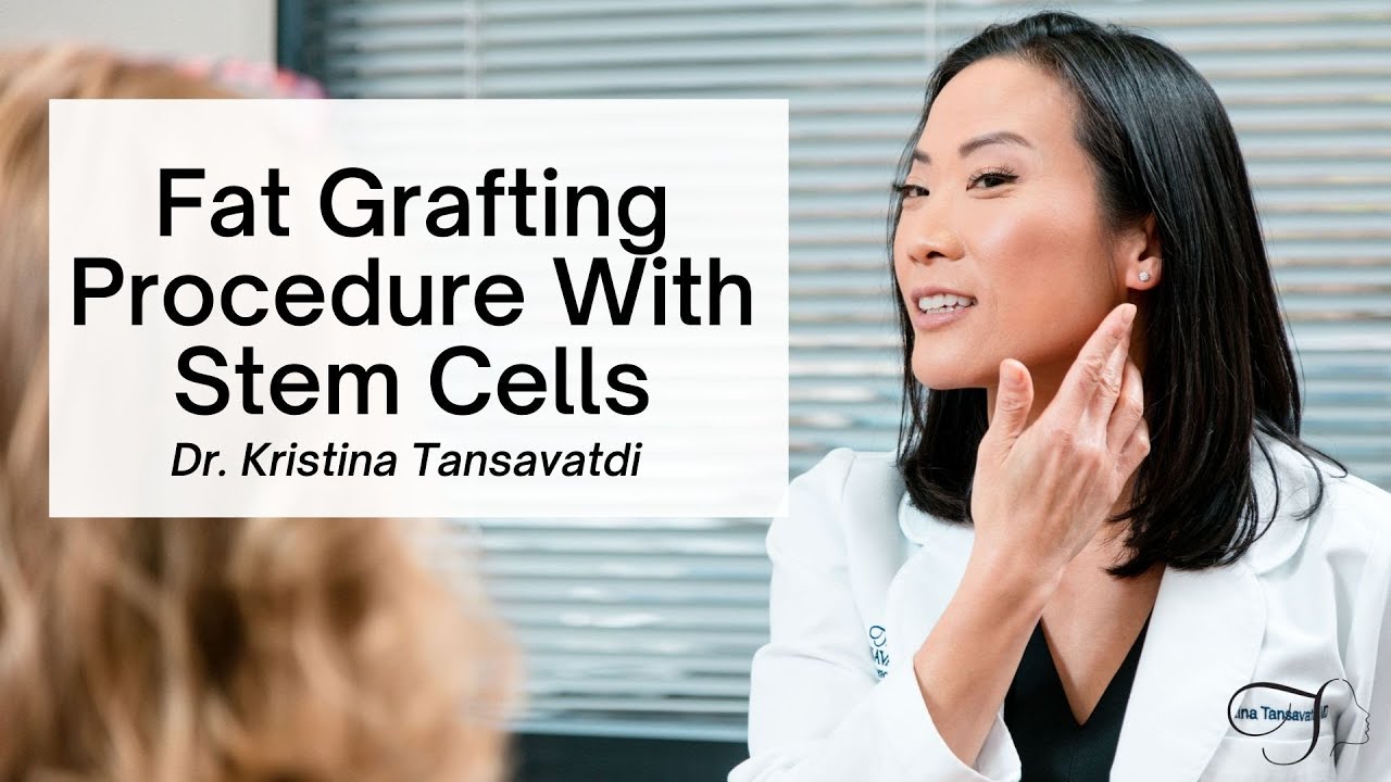 Fat Grafting Procedure with Stem Cells Explained by Dr. Tansavatdi