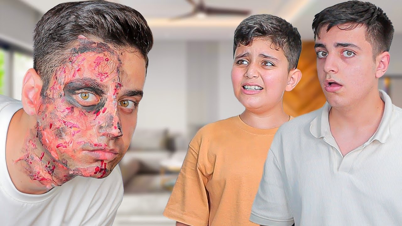 مقلب الوجه المحروق🔥 ردة فعل أحمد صدمتني💔ما نسو وجبات الأكل!