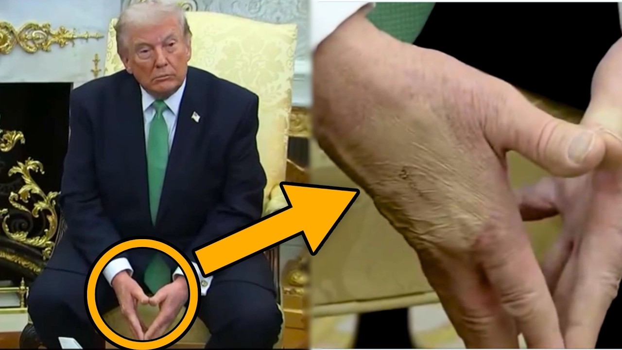 Гниющая рука Трампа ЗЕЛЕНЕЕТ