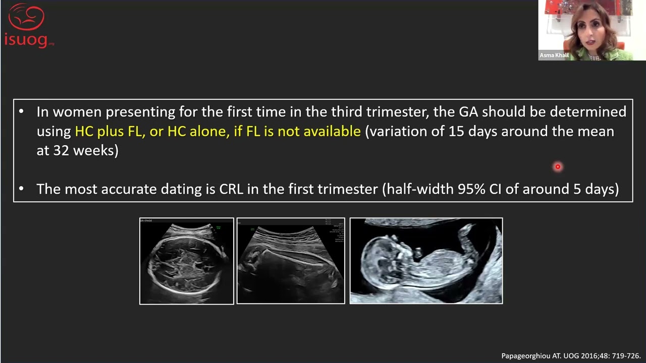 ISUOG guideline on the third-trimester ultrasound - Professor Asma Khalil