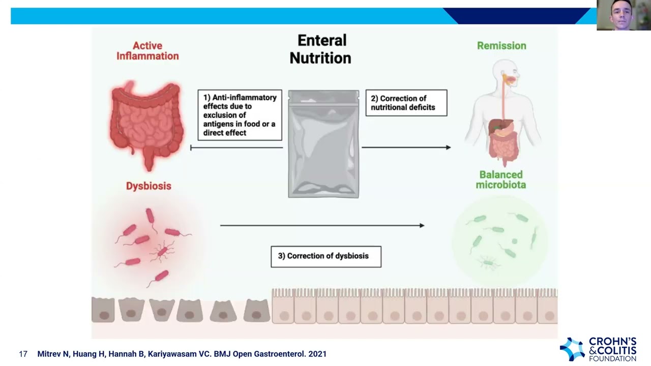 MyIBD Learning Webinar: Diet as Therapy in IBD
