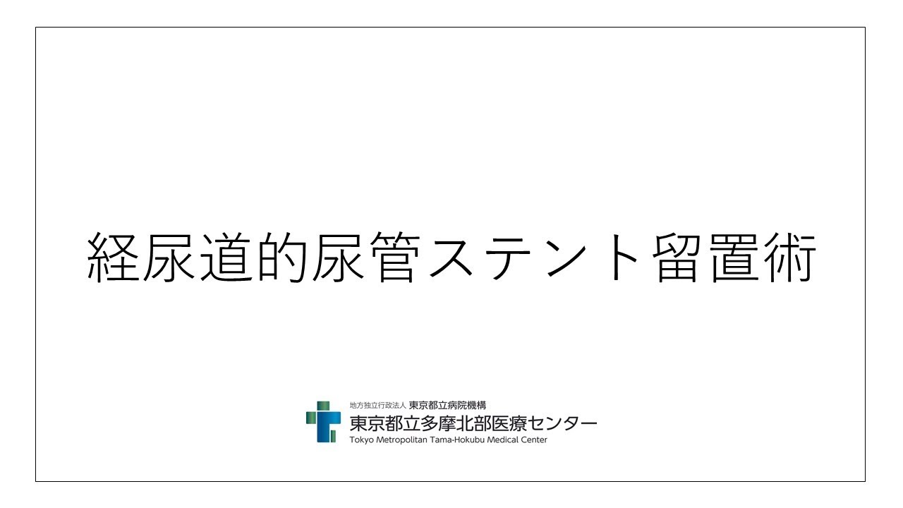 経尿道的尿管ステント留置術説明動画