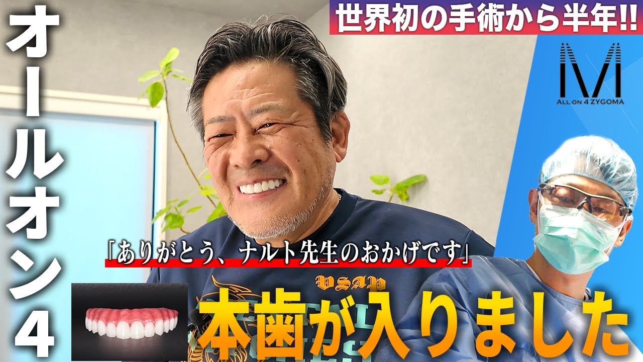 本日、オールオン4の本歯が入りました！あの感動のダブル手術から劇的に変わったその理由とは？ナルト先生との再会と感謝の言葉にスタッフ一同も涙しました