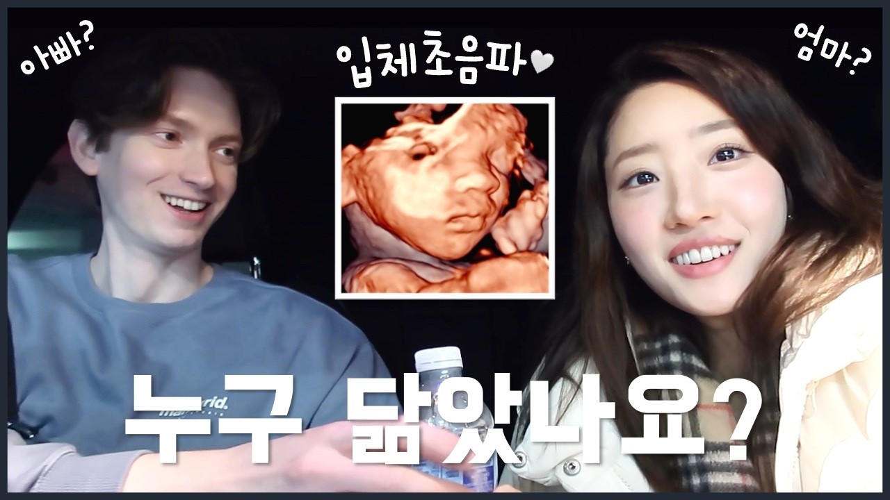 🇰🇷🇬🇧입체초음파👼🏻 누구를 더 닮았을까?!🤔 임신 후기 점점 세지는 태동🤰 | 콩스터Kongster