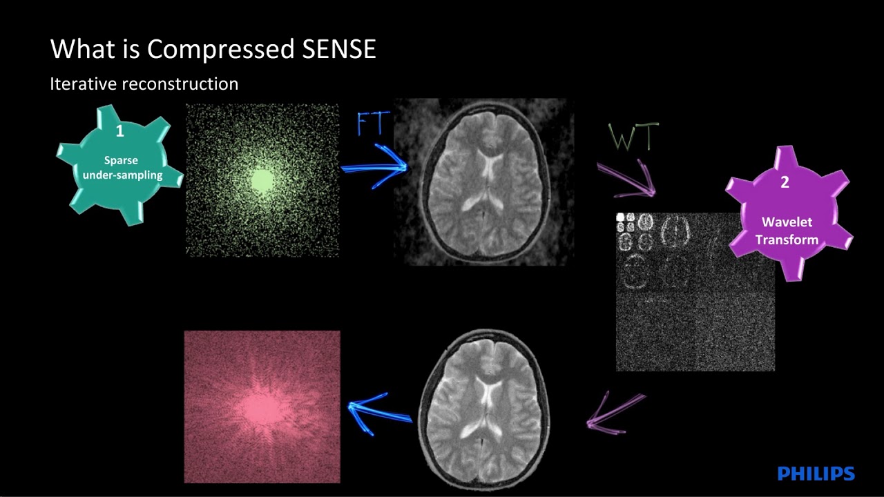 Compressed SENSE webinar by Dr. Jan. W. Casselman