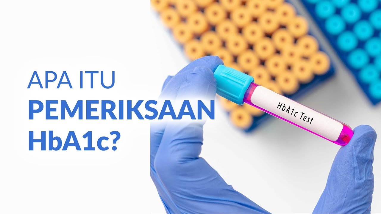 Pemeriksaan HbA1c untuk Mendeteksi dan Mengontrol Diabetes
