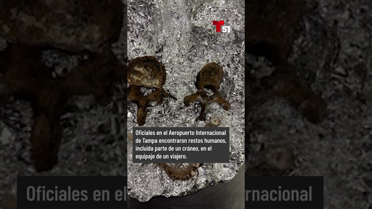 Restos humanos hallados en equipaje de viajero en Tampa, eran &ldquo;para rituales&rdquo;