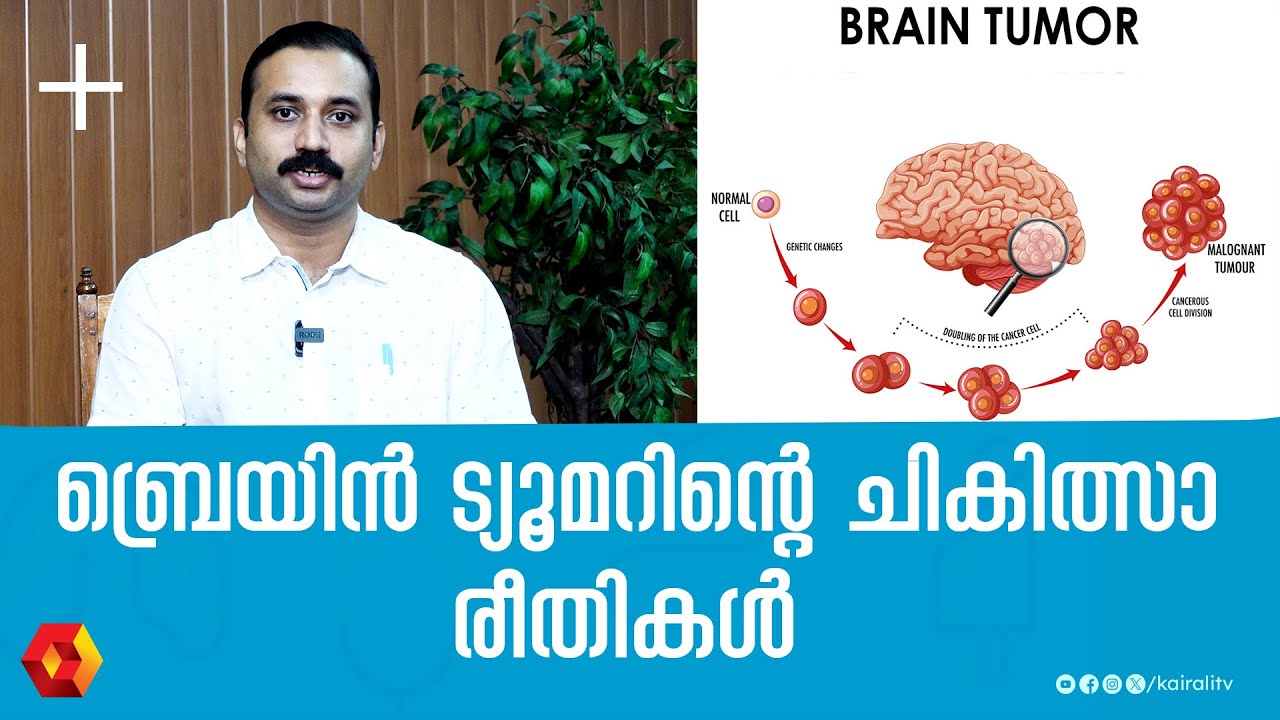 തലയിലെ എല്ലാ മുഴകളും ക്യാൻസർ ആകണമെന്നില്ല| dr manoj vellanad | Brain tumor symptoms​​ | Brain tumors