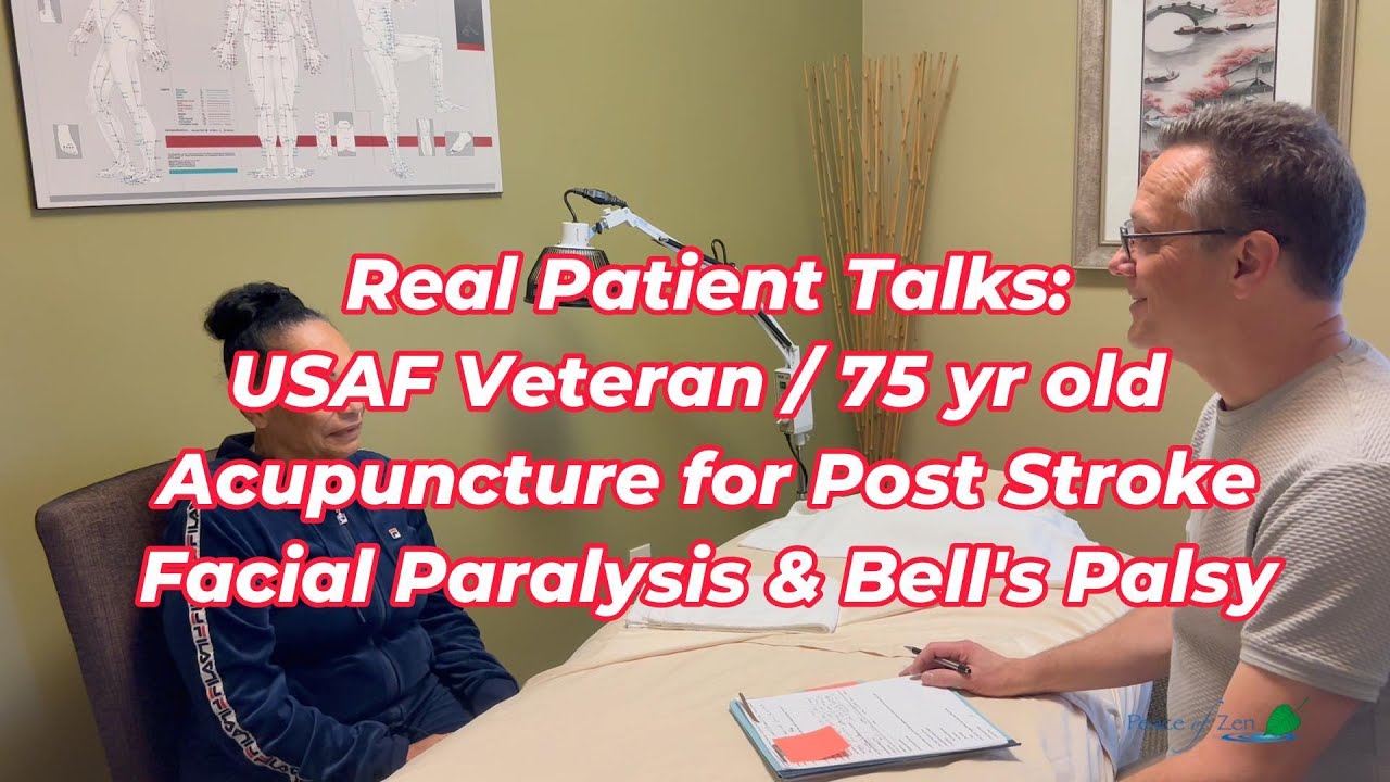 A Stroke Survivor’s Acupuncture Journey: From Facial Drooping to Healing