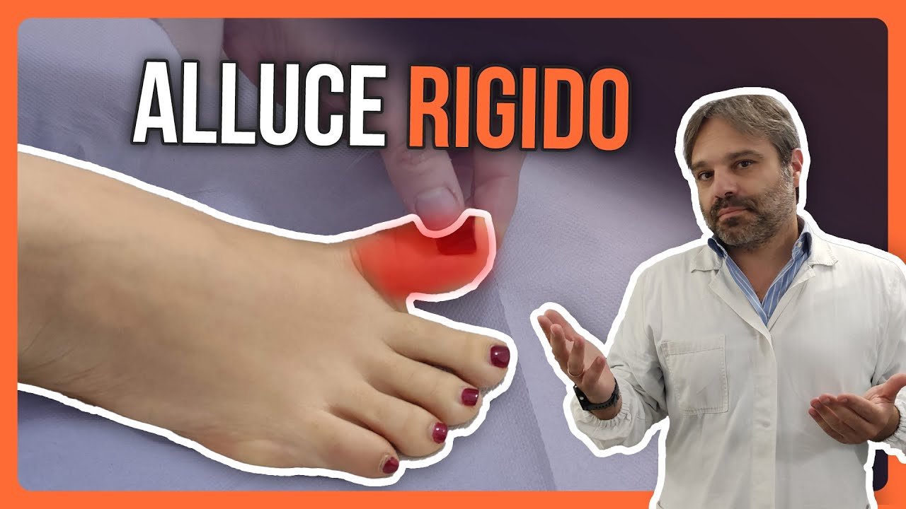 ALLUCE RIGIDO come si CURA? Scopri gli AUTOTRATTAMENTI